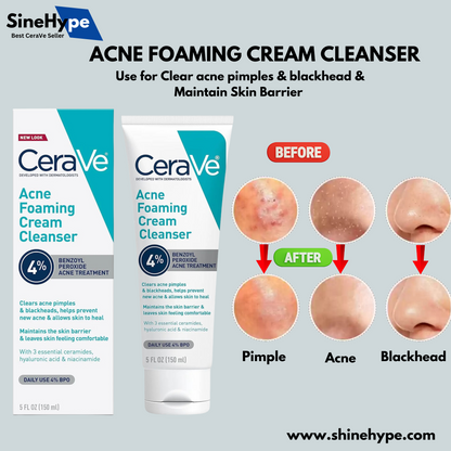 Acne Foaming Cream Cleanser