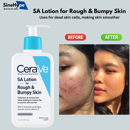 CeraVe  SA Lotion for Rough & Bumpy Skin 237ML